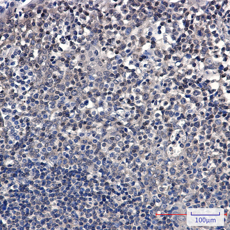 SUMO Conjugating Enzyme UBC9 Rabbit mAb